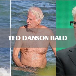 “Is Ted Danson bald?”: Answer Revealed And 5 Solutions To Baldness