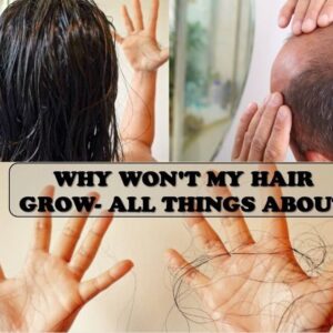 Why won’t my hair grow – Top 5 Reasons And 4 Best Solutions